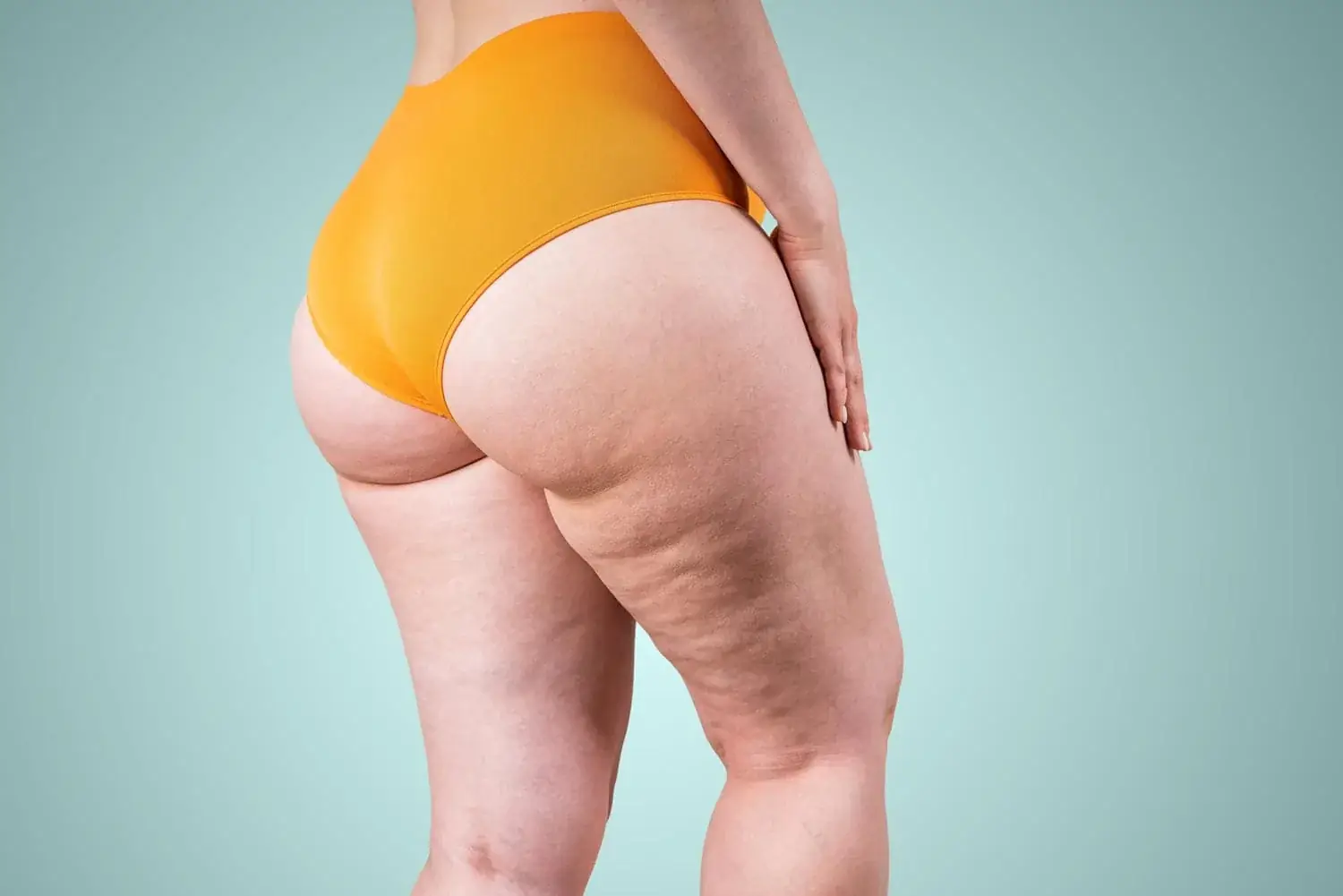 Fisioterapia Dermatofuncional en Lipedema, Fisioterapia Barón - Móstoles